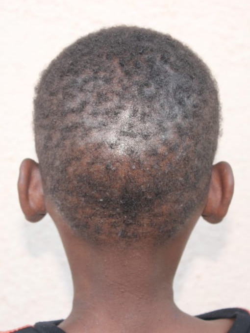 medical-expense-assistance